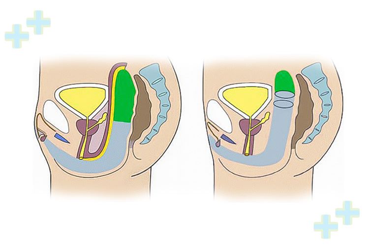 Gender reassignment surgery consultation with medical professionals.