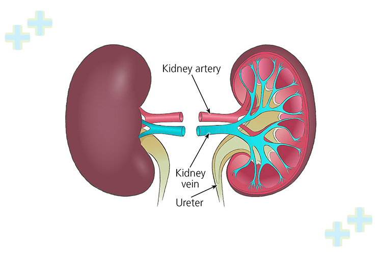 Post-surgery image of a kidney transplant recipient.