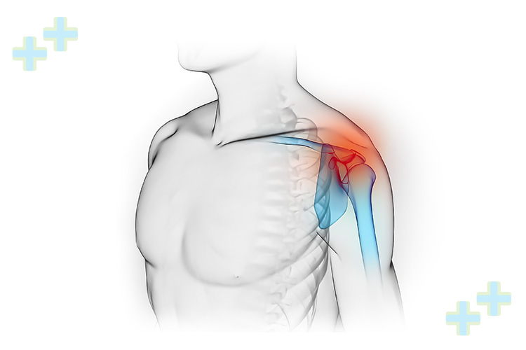 Shoulder dislocation treatment with detailed focus.