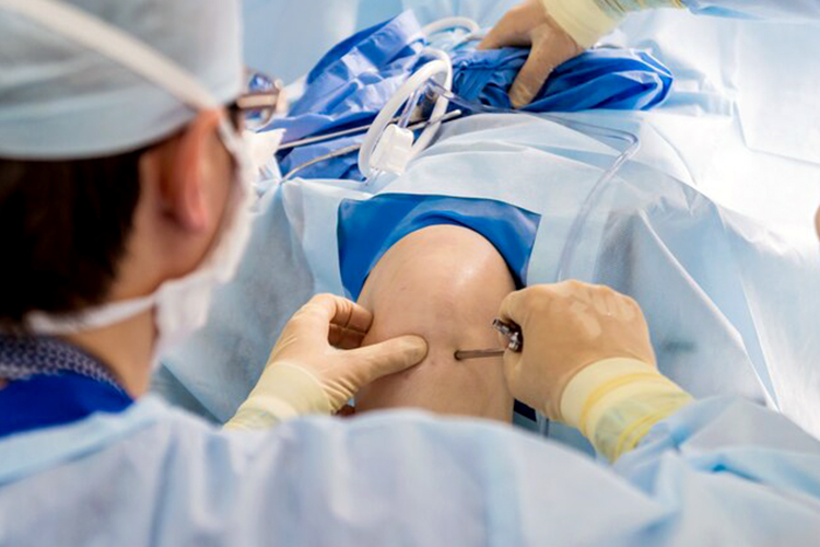 Orthopedic Surgery