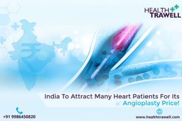 Angioplasty Price