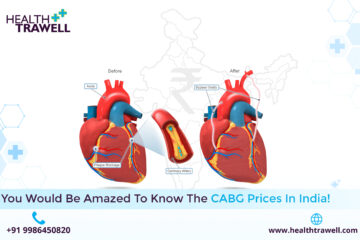 CABG Prices in India