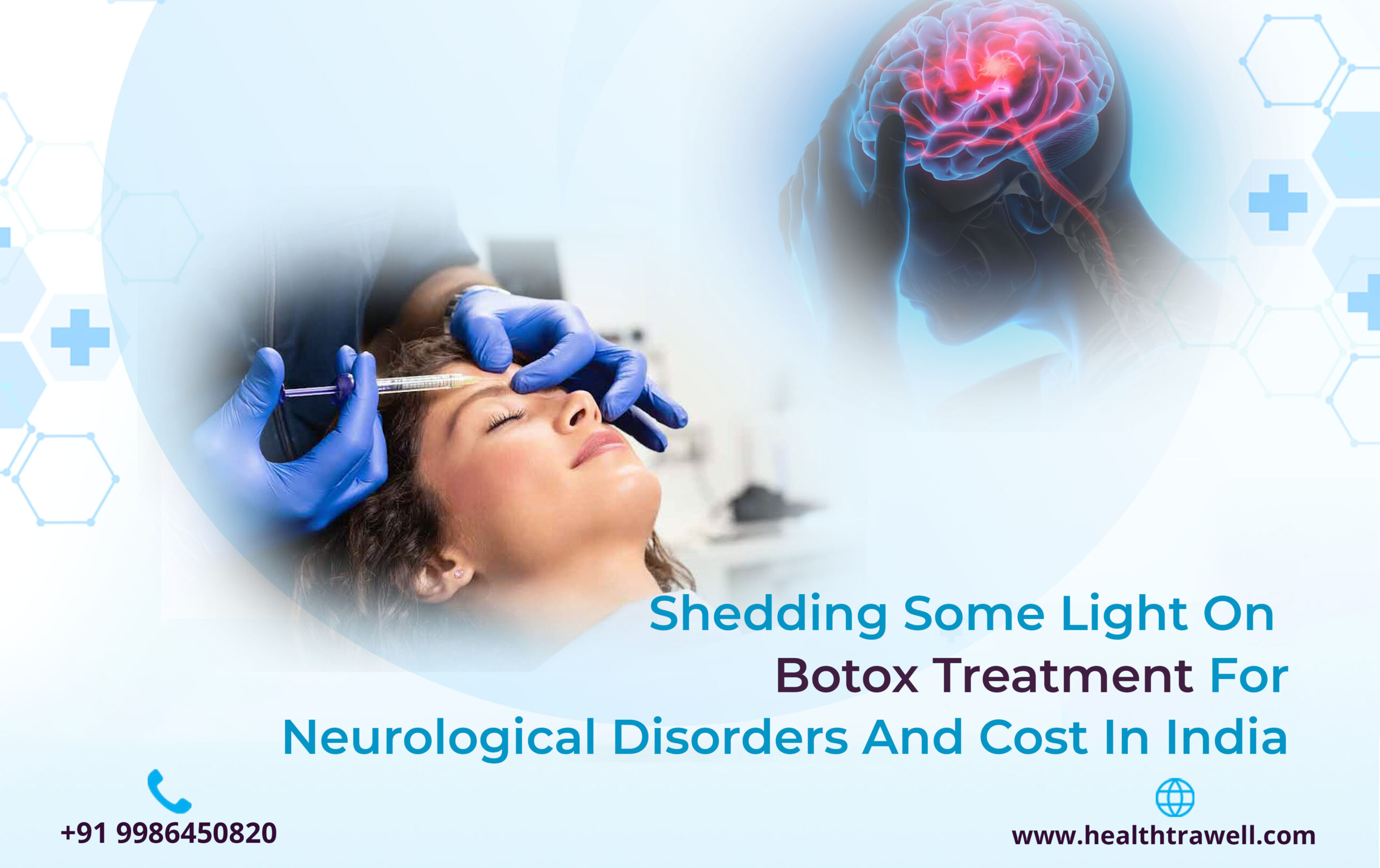 Shedding Some Light on Botox Treatment for Neurological Disorders and ...