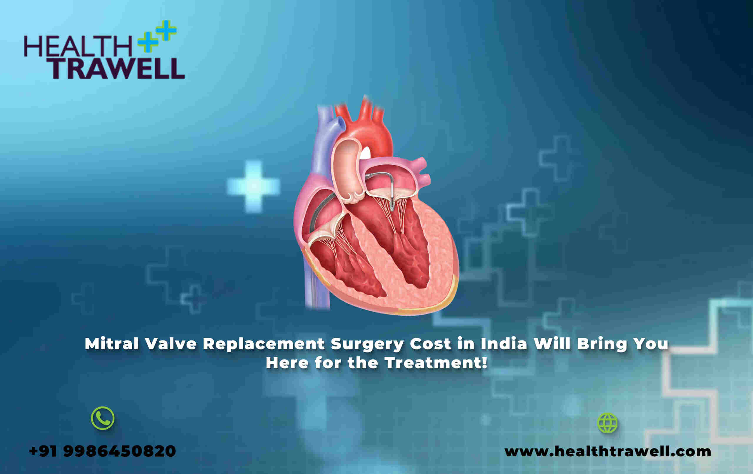 Healthcare: Mitral Valve Replacement Surgery Cost in India