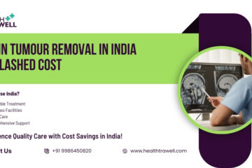 affordable brain tumor removal procedures available in India.