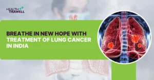 treatment of lung cancer in India