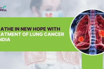 treatment of lung cancer in India