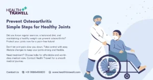 How Can We Prevent Osteoarthritis