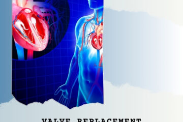 Valve Replacement: A Heartbeat of Hope in India