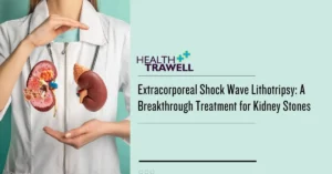 extracorporeal shock wave lithotripsy