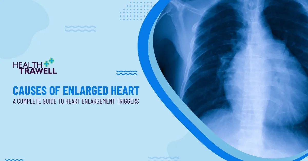 causes of enlarged heart