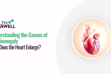 causes of cardiomegaly