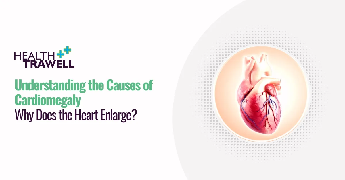 causes of cardiomegaly