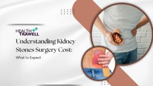 Kidney Stones