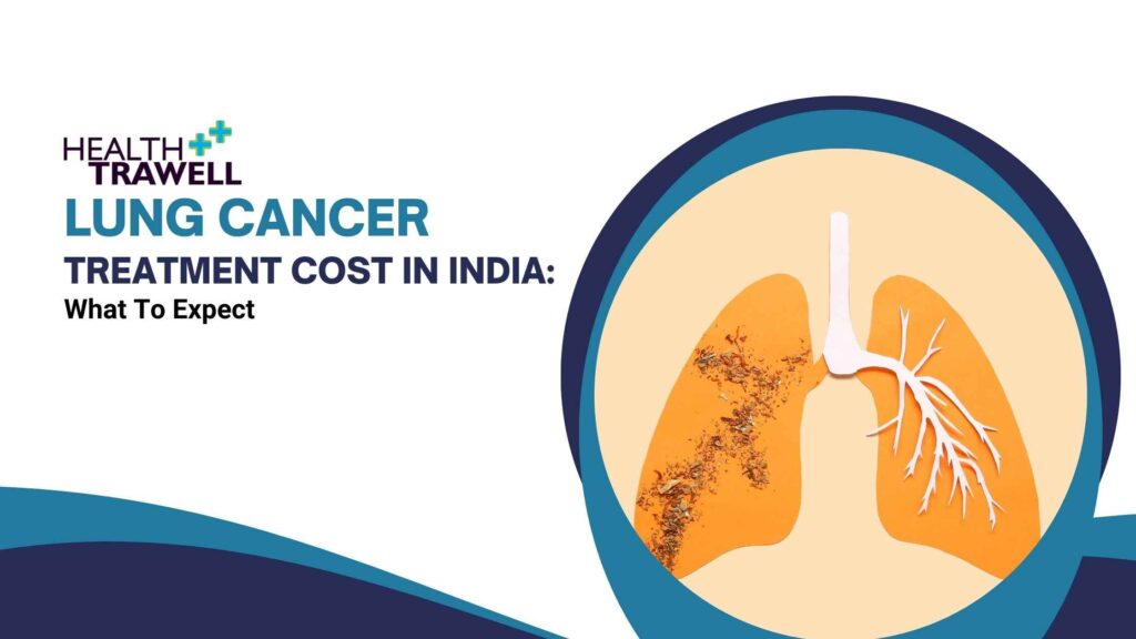 Lung Cancer