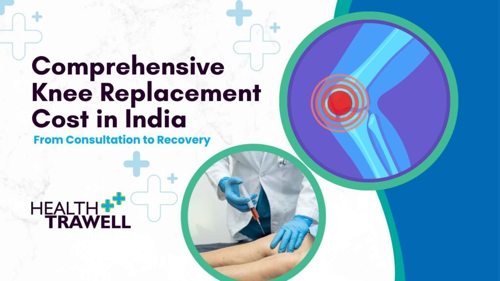 Knee Replacement