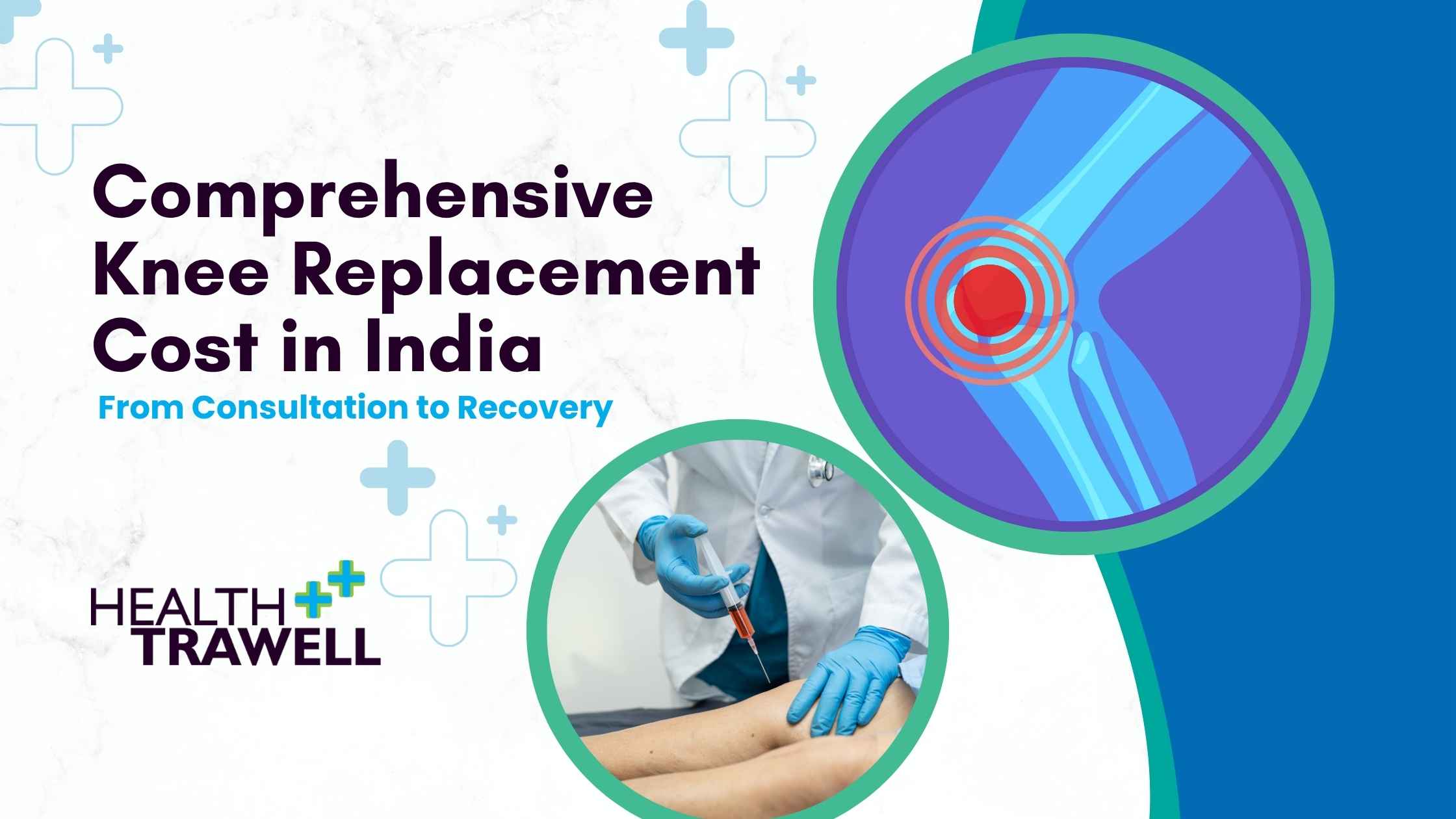 Knee Replacement