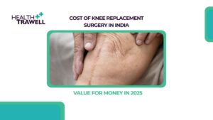 Knee Replacement Surgery