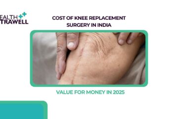 Knee Replacement Surgery