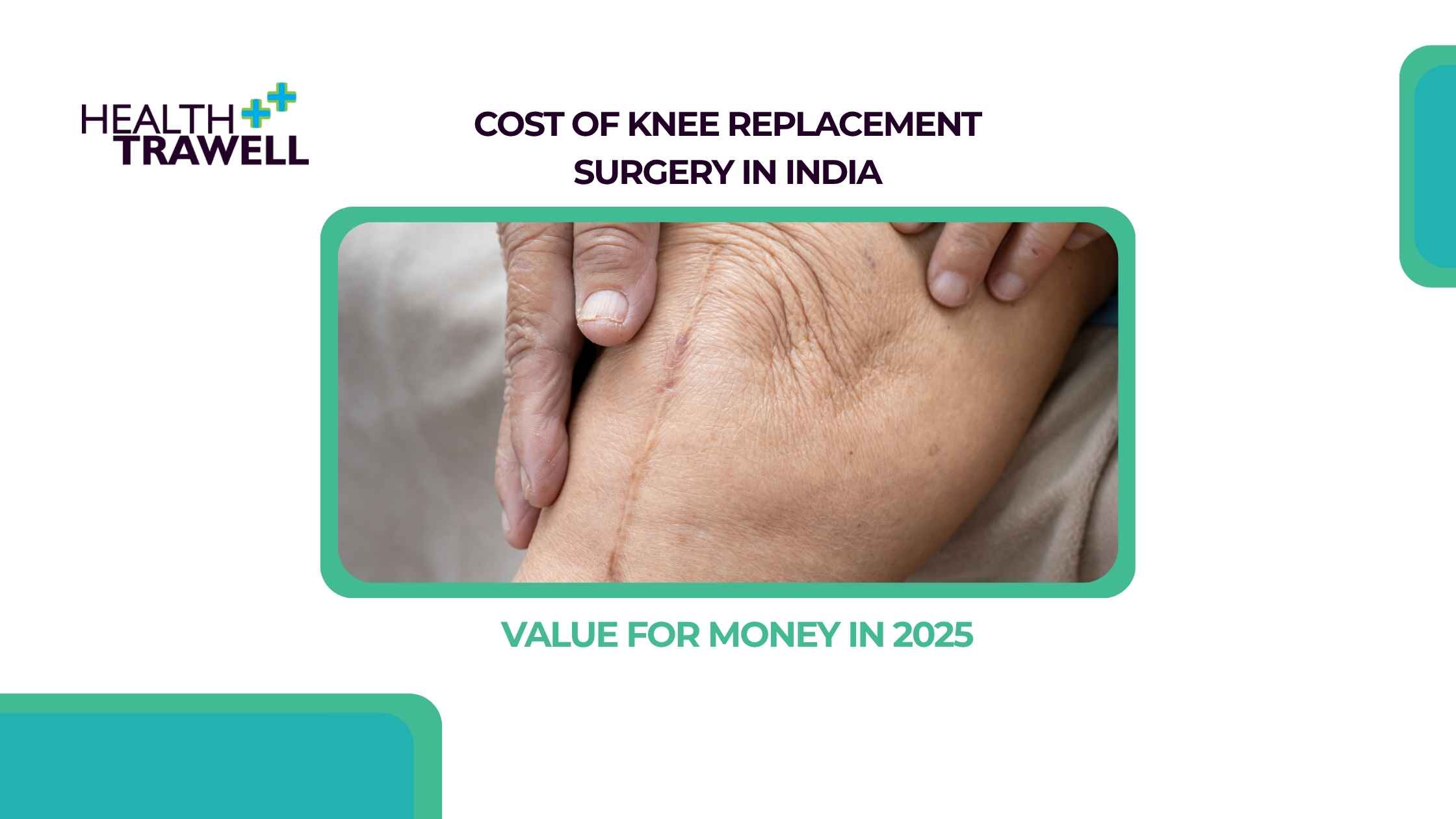 Knee Replacement Surgery
